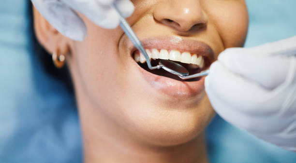 Best Emergency Dental Extractions in Whitehall, WI